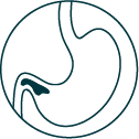 allurion gastric ballon in kenya