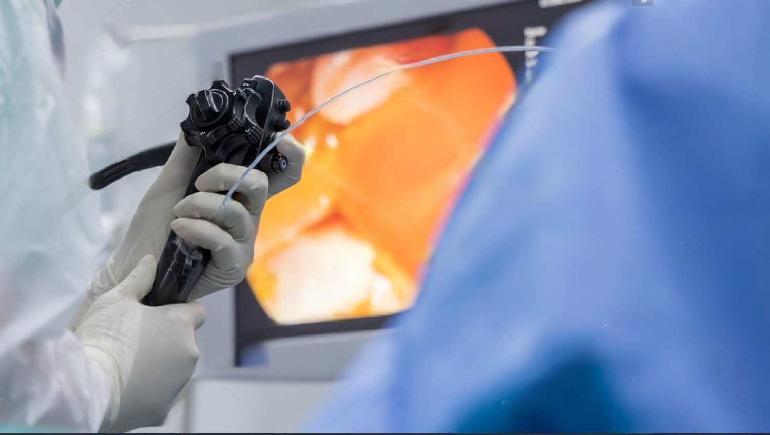ERCP - Endoscopic Retrograde CholangioPancreatography  